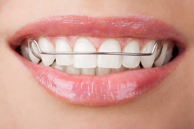 牙科口腔牙齿素材