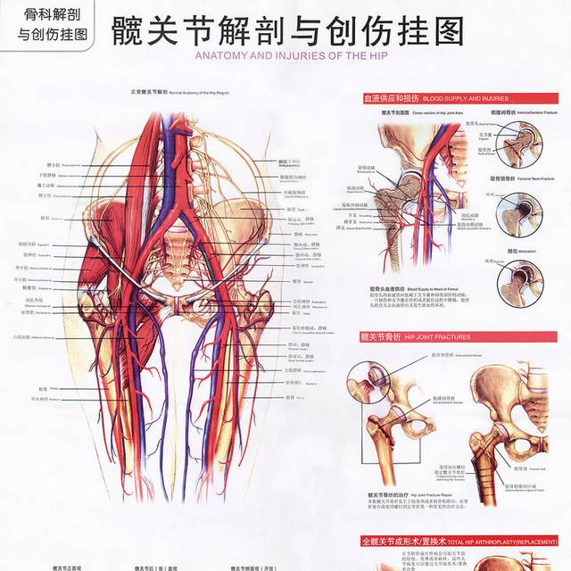 髋关节解剖图