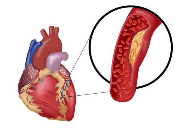 心脏细节图