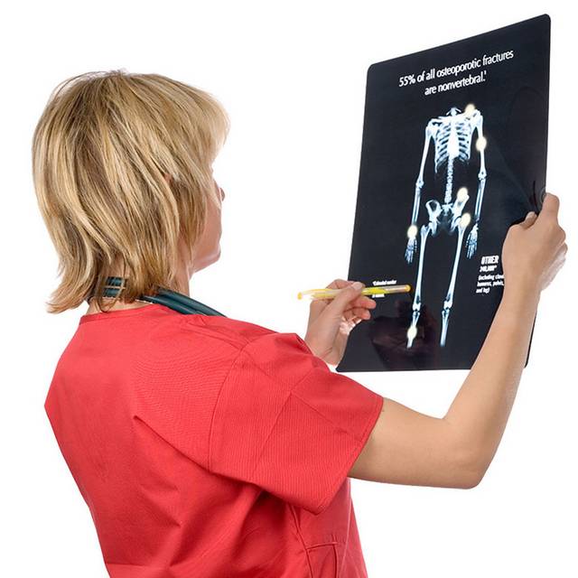 骨骼X光片
