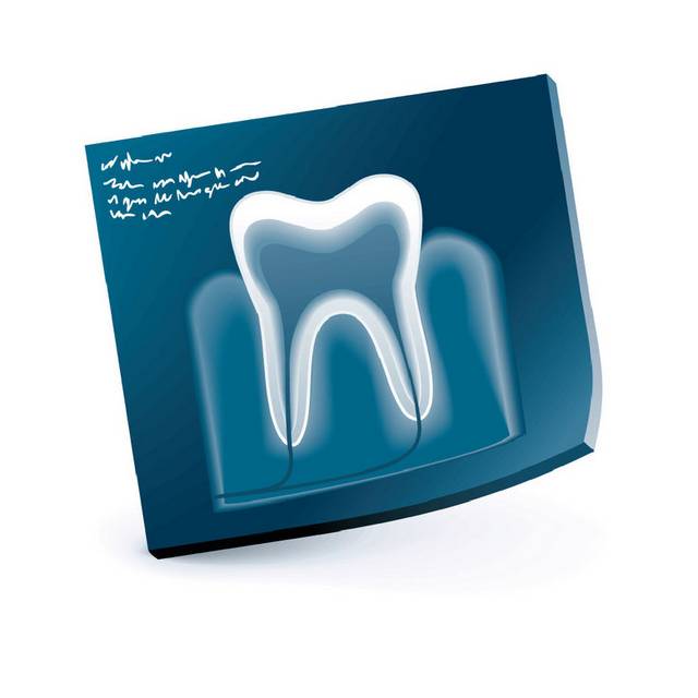 牙齿X光片素材